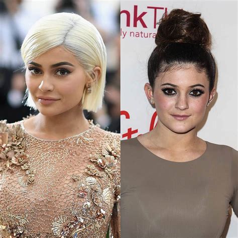 kylie vorher nachher|Kylie Jenner: So sah sie vor den Beauty